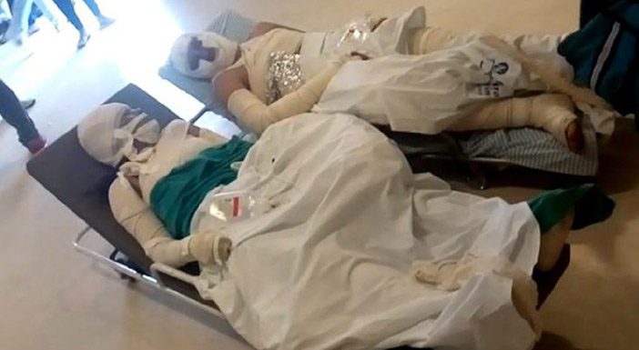 A imagem dos corpos de Josefa e Mirosmar comletamente enfaixados, lado a lado, na chegada ao Hospital da Restauração é marcante. Difícil de esquecer